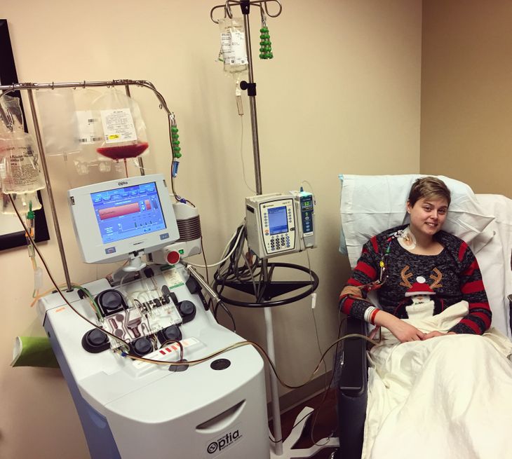 A Stem Cell Transplant for Systemic Sclerosis